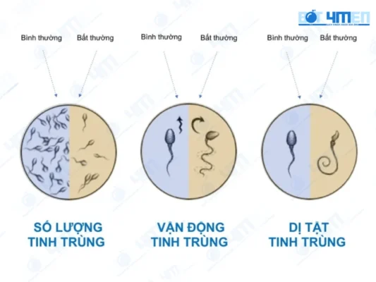 Xét nghiệm tinh dịch