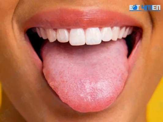 Lưỡi bị bẩn gây ra hôi miệng
