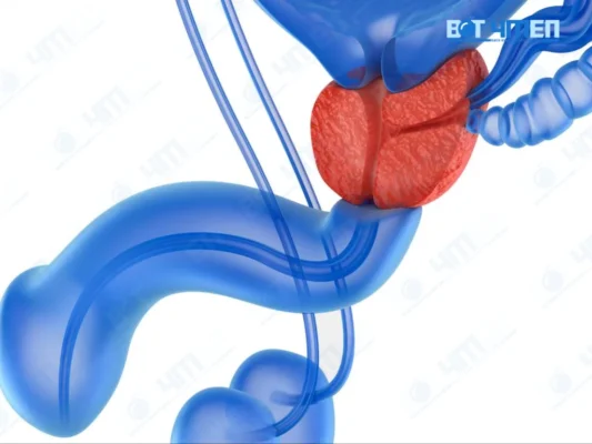 Cách điều trị viêm tuyến tiền liệt