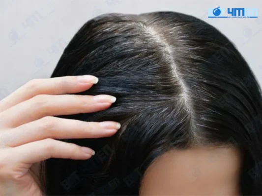 Cách phòng ngừa tóc bạc sớm hiệu quả