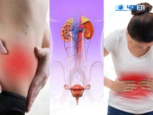 Chuẩn đoán bị viêm đường tiết niệu