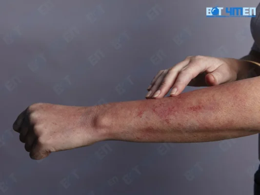 HIV là gì