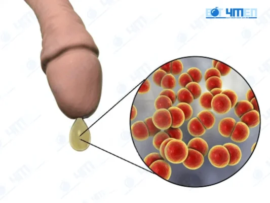 Kết luận từ chuyên gia