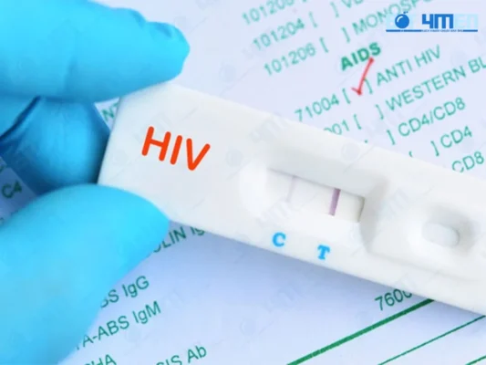 Khi nào nên xét nghiệm HIV