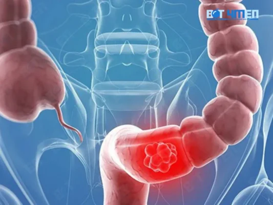Phòng ngừa và phát hiện ung thư tinh hoàn
