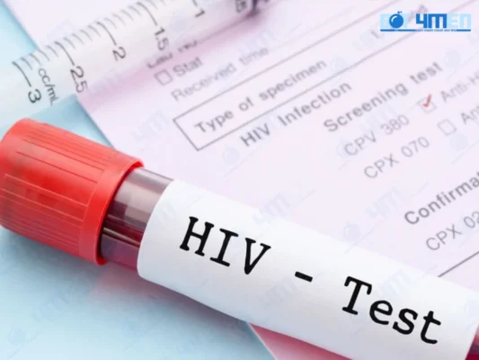 Phương pháp chuẩn đoán HIV