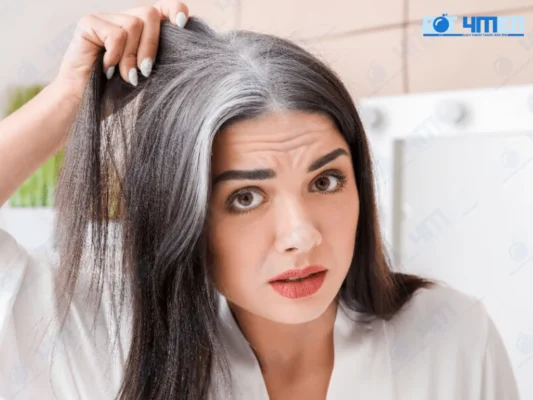 Tóc bạc sớm có chữa được không