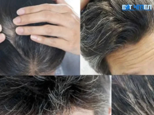 Tóc bạc sớm ở nam nữ có gì khác nhau