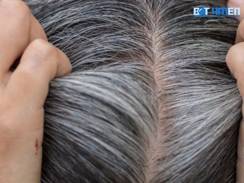 Vì sao tóc bạc sớm