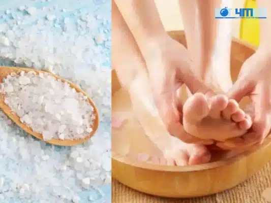 Hiểu về ra mồ hôi tay chân và tại sao cần tìm cách trị