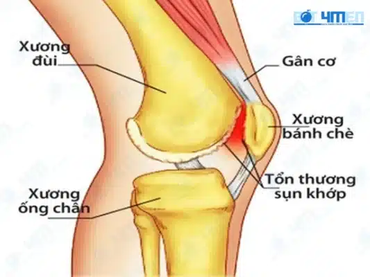 Cách chuẩn đoán
