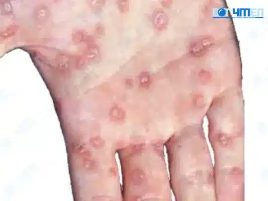 Quá trình hình thành bệnh AIDS