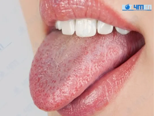 Các bệnh lý về răng miệng và môi trường khô miệng