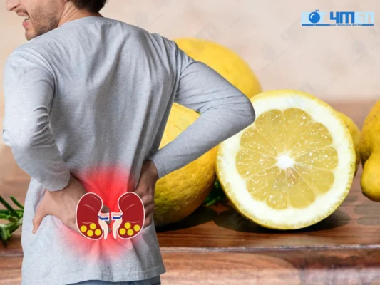 Phòng Ngừa Sỏi Thận
