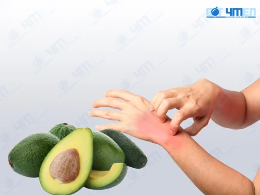 Nguy Cơ Dị Ứng