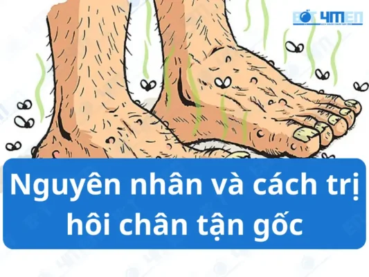 Nguyên nhân và cách trị hôi chân tận gốc