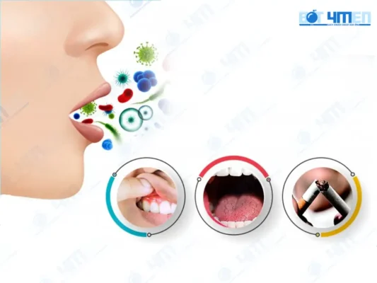 Nguyên nhân và cách trị hôi miệng tận gốc không lo tái phát